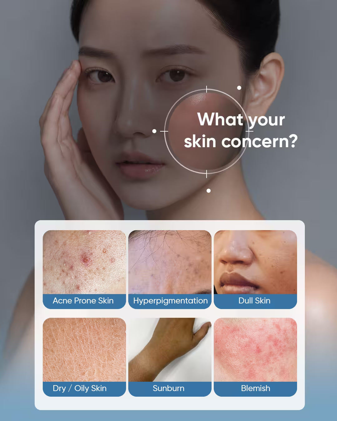 A skincare chart asking 'What is your skin concern?' showing 6 conditions: acne prone skin, hyperpigmentation, dull skin, dry or oily skin, sunburn, and blemish.