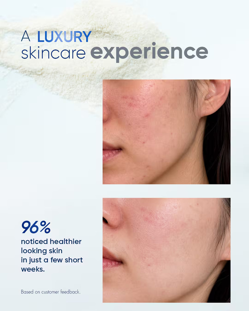 Before and after skin transformation results from using bykare Lipo Crystal luxury skincare supplement, showing visible acne reduction on the cheek. Image text states 96% noticed healthier looking skin in just a few short weeks based on customer feedback.